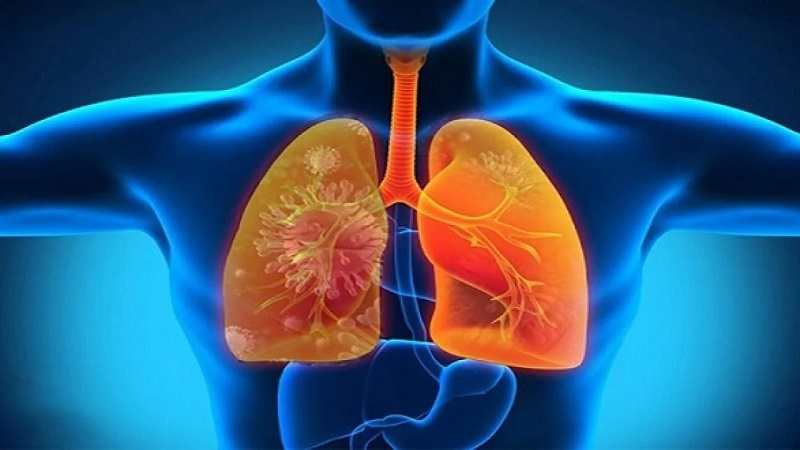 Tăng thể tích phổi