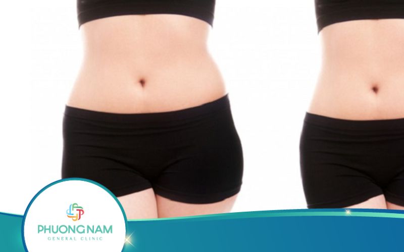 Những Cách Giảm 15Kg Trong 1 Tuần Nhanh Chóng