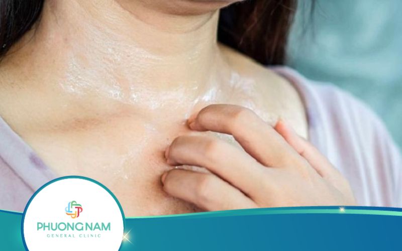 Vì Sao Uống Thuốc Giảm Cân Ra Mồ Hôi Nhiều?