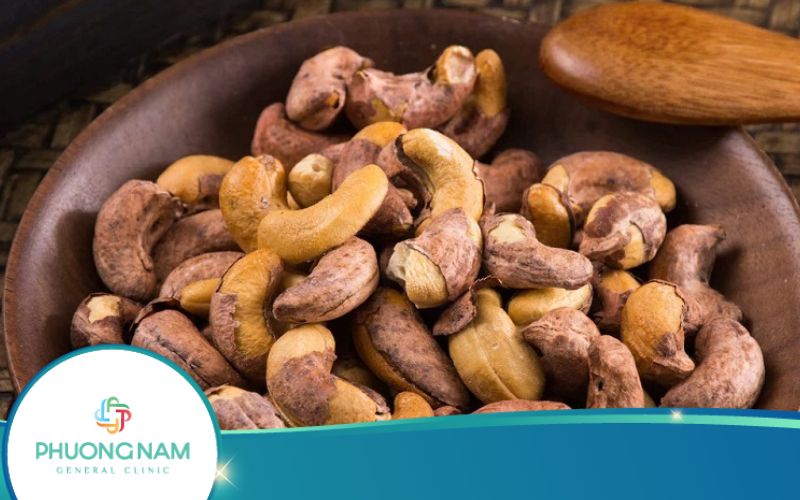 Hạt Điều Bao Nhiêu Calo? Hạt Điều Giảm Cân Như Thế Nào?