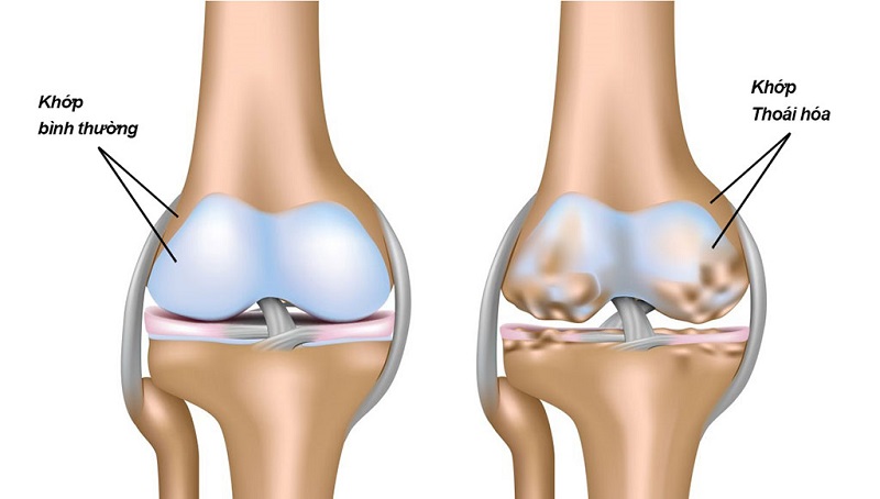 Công dụng của rau đay