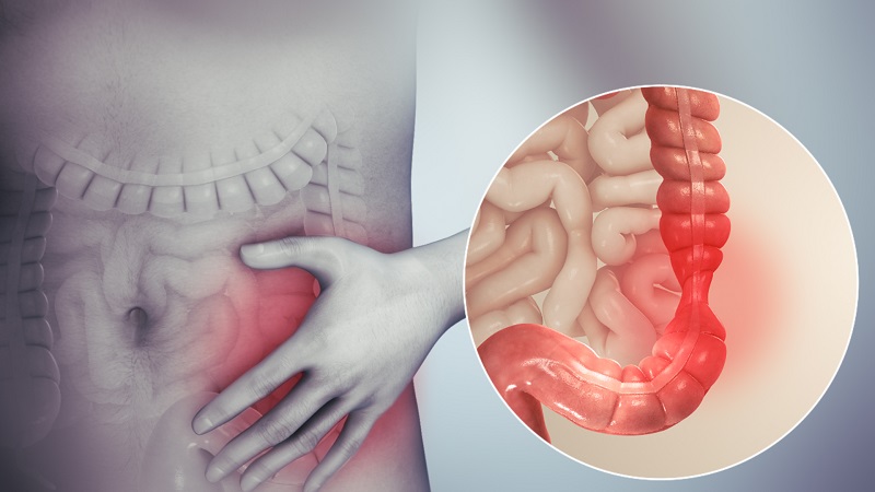 Hội chứng IBS tuy lành tính và không gây nguy hiểm đến tính mạng, nhưng chúng lại ảnh hưởng tiêu cực đến chất lượng cuộc sống cũng như sức khỏe người bệnh.