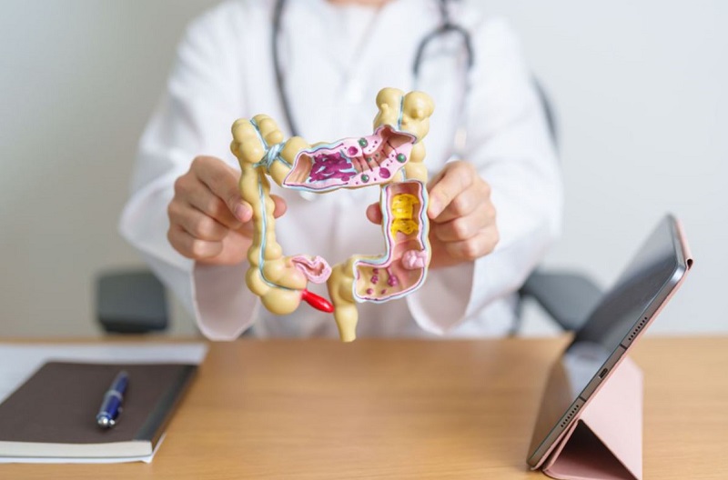 Hội chứng IBS không hẳn là một bệnh lý mà là tình trạng rối loạn tiêu hóa kéo dài, do nhiều nguyên nhân khác nhau.