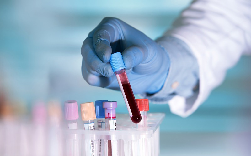 Đa khoa Phương Nam là một cơ sở xét nghiệm máu uy tín tại Đà lạt với công nghệ, kỹ thuật tiên tiến