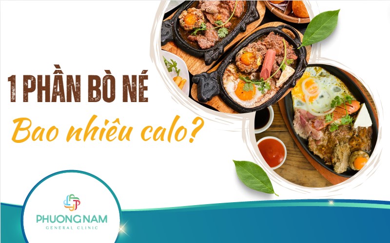 1 phần bò né bao nhiêu calo? Mẹo kiểm soát calo khi ăn bò né