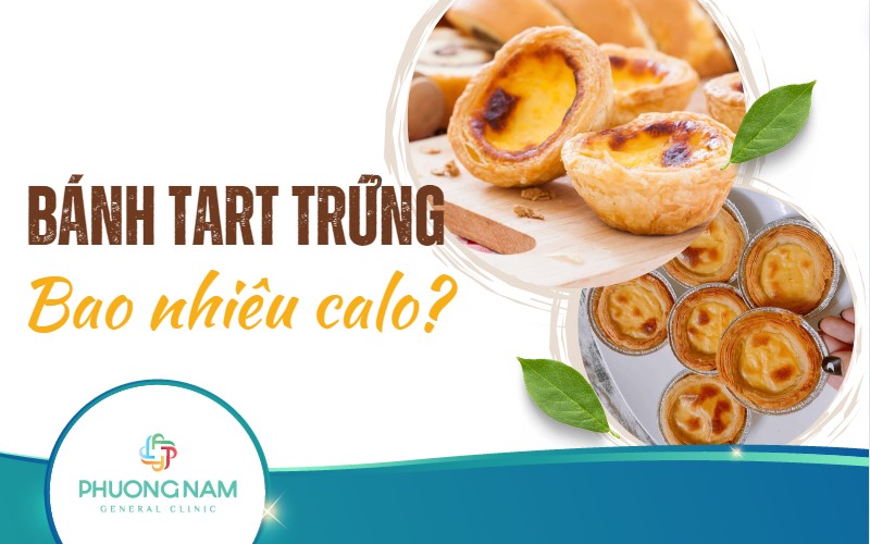 1 bánh tart trứng bao nhiêu calo? Có béo không?