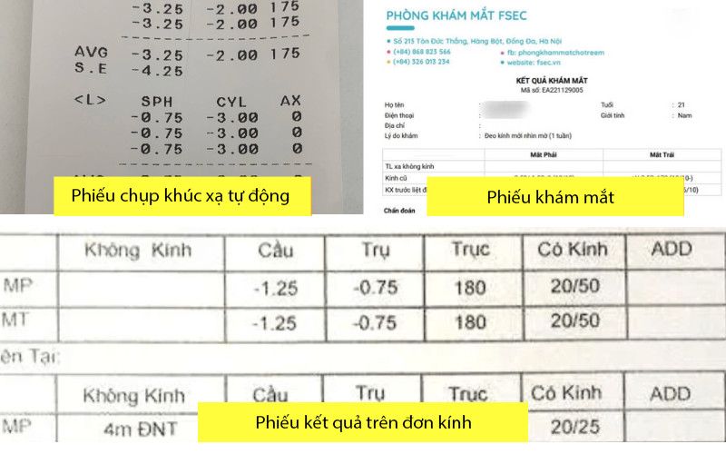 có nhiều loại phiếu khám mắt khác nhau, tùy thuộc vào mục đích khám và thiết bị đo lường mà cơ sở y tế sử dụng