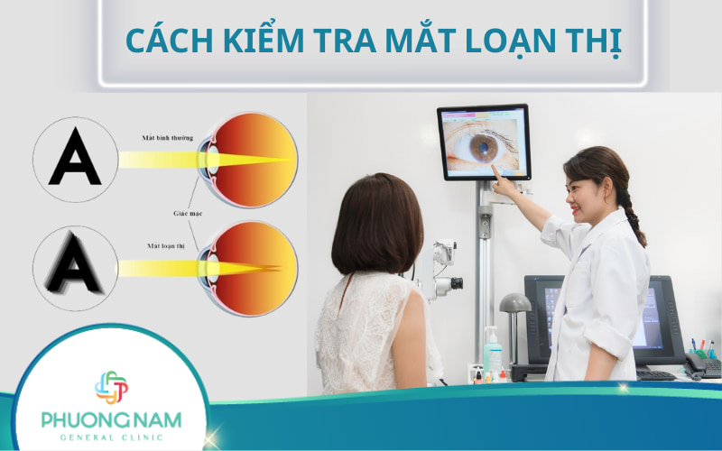 Cách kiểm tra mắt loạn thị như thế nào tại nhà & phòng khám?