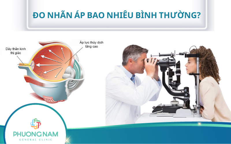 Đo nhãn áp bao nhiêu là bình thường? Các chỉ số nhãn áp quan trọng