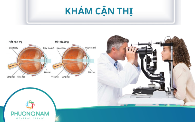 Khám cận thị: Tầm quan trọng, quy trình & phương pháp điều trị