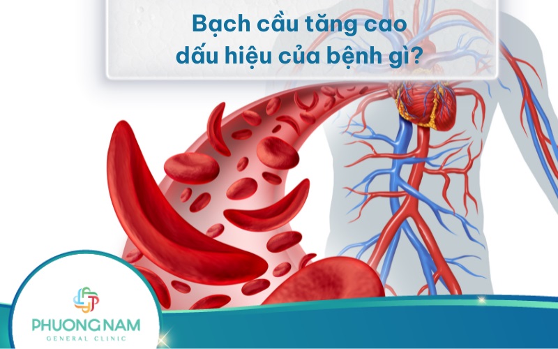Bạch cầu tăng cao là dấu hiệu của bệnh gì và có nguy hiểm không?
