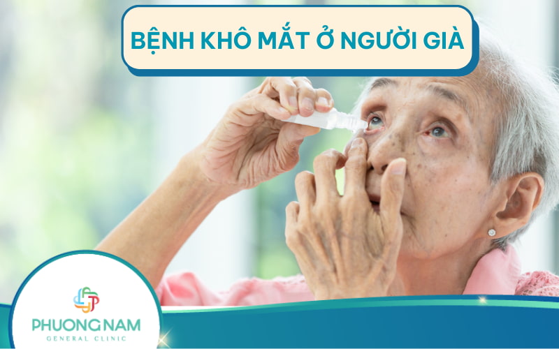 Bệnh khô mắt ở người già: Nguyên nhân, cách phòng tránh