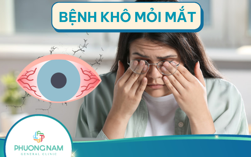 Bệnh khô mỏi mắt: Nguyên nhân, triệu chứng và cách điều trị
