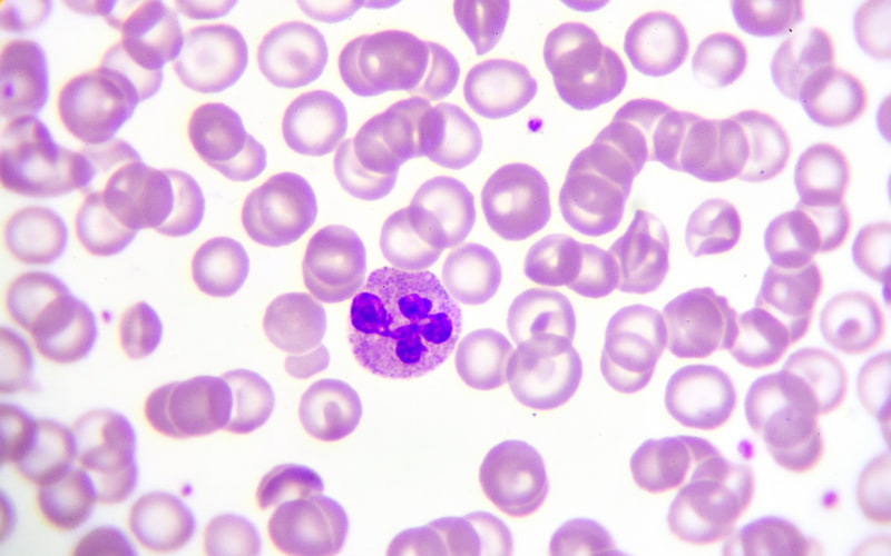 Bạch cầu trung tính (Neutrophil) là một loại bạch cầu hạt, chiếm số lượng lớn nhất trong hệ thống miễn dịch của cơ thể. 