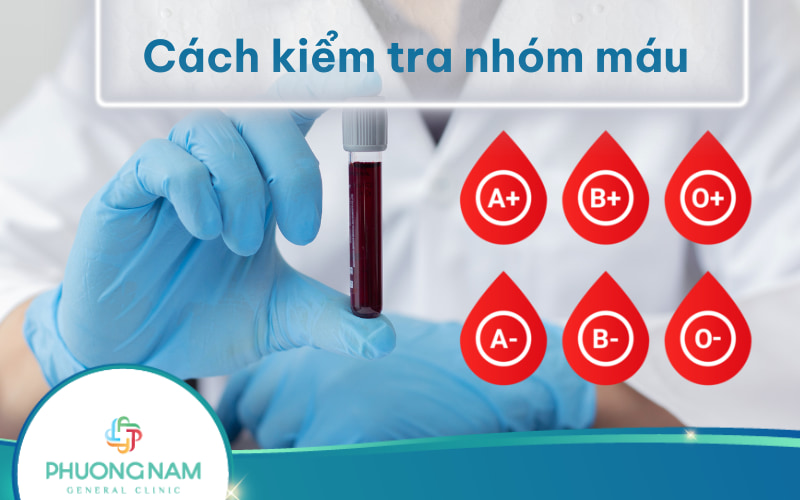 4 Cách kiểm tra nhóm máu nhanh chóng, chính xác