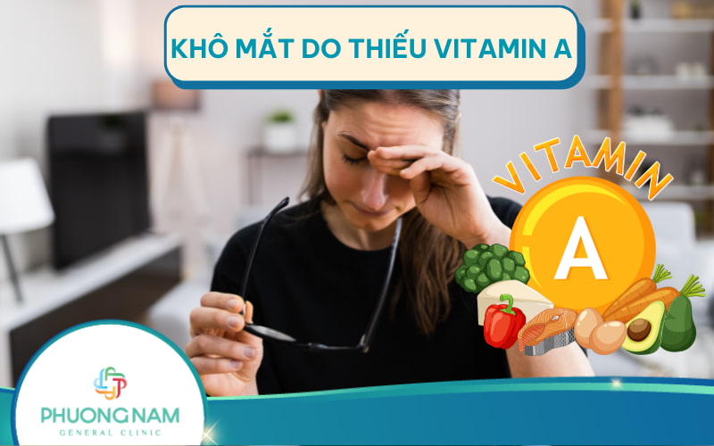 Khô mắt do thiếu vitamin A: Nguyên nhân, triệu chứng và điều trị