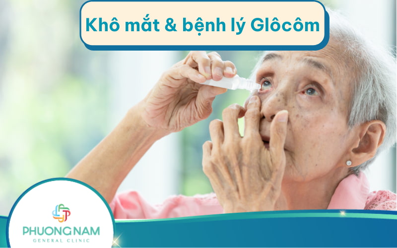 Mối liên hệ giữa khô mắt và bệnh lý glôcôm như thế nào?