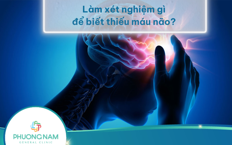 Bác sĩ tư vấn: Làm xét nghiệm gì để biết thiếu máu não?