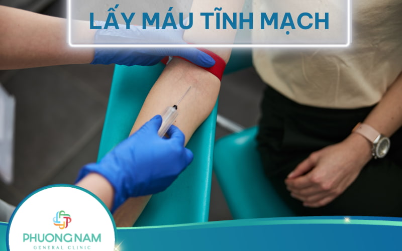 Lấy máu tĩnh mạch: Quy trình và những điều cần lưu ý
