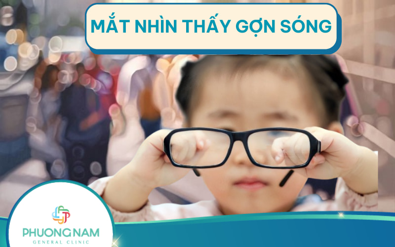 Mắt nhìn thấy gợn sóng là dấu hiệu bệnh gì?