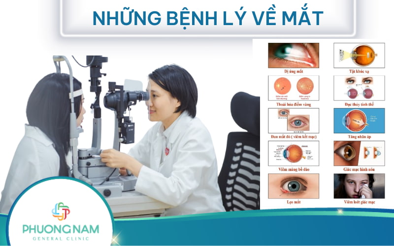 Những bệnh lý về mắt thường gặp: Nguyên nhân và cách phòng ngừa