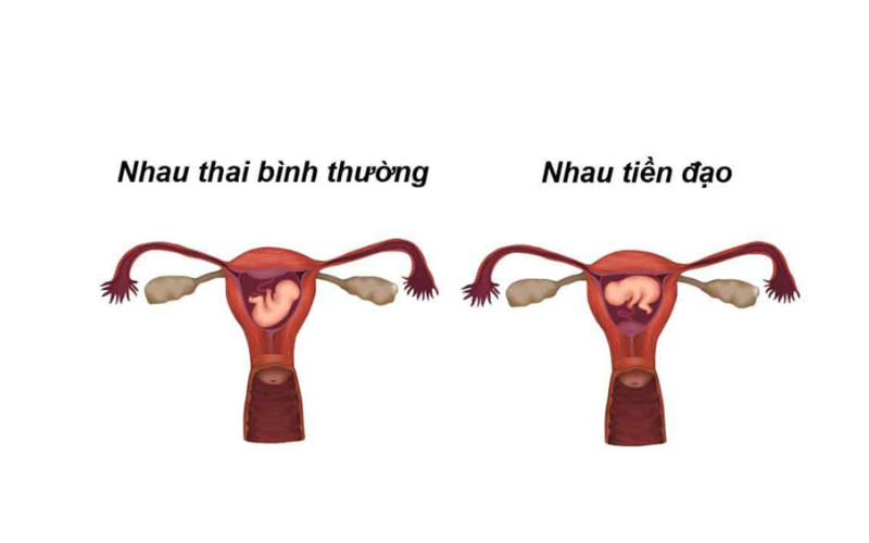 Siêu âm 2D giúp mẹ bầu theo dõi và phát hiện sớm những biến chứng trong quá trình mang thai