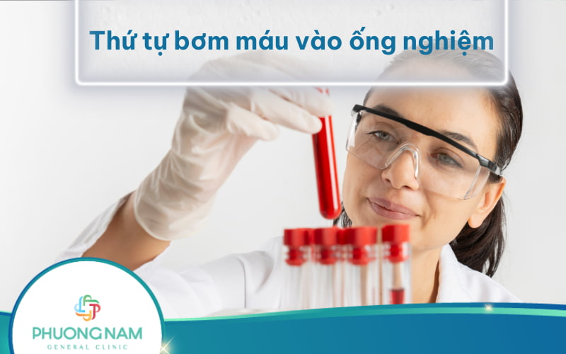 Hướng dẫn Thứ tự bơm máu vào ống nghiệm chuẩn