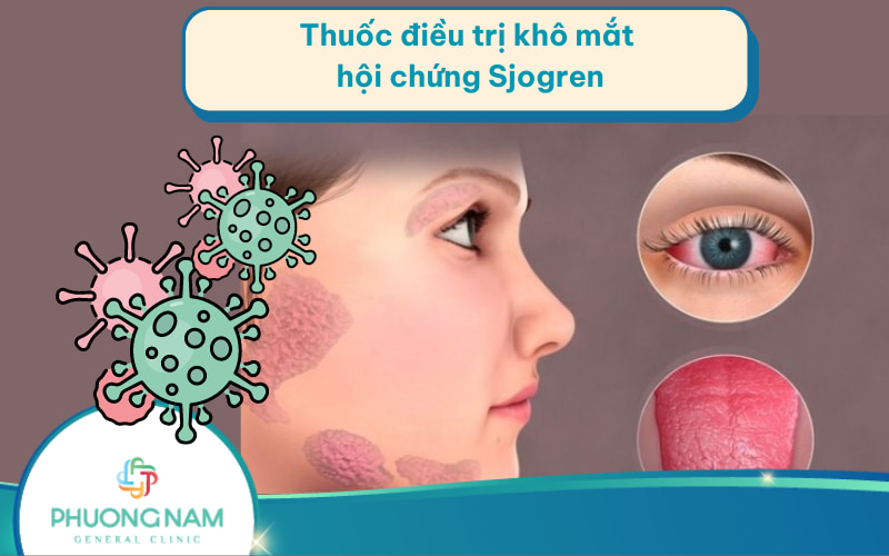 Thuốc điều trị khô mắt trong hội chứng Sjogren hiệu quả, an toàn