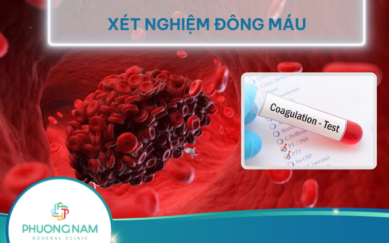 Xét nghiệm đông máu là gì? Các loại xét nghiệm đông máu hiện nay