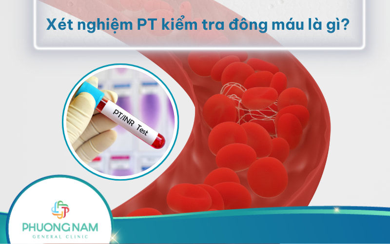 Xét nghiệm PT kiểm tra đông máu là gì? Và các yếu tố ảnh hưởng