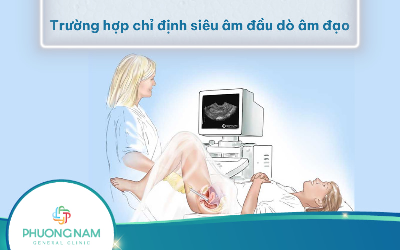 Các trường hợp chỉ định siêu âm đầu dò âm đạo và chống chỉ định cần biết