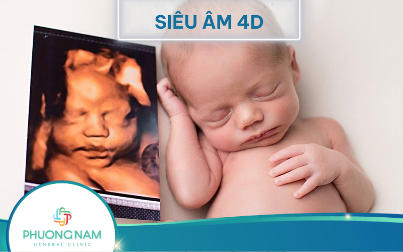 Lợi ích của siêu âm 4D và nên thực hiện vào tháng thứ mấy?