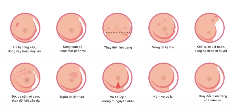 Phụ nữ nên thực hiện siêu âm vú định kỳ và đi khám ngay khi có những dấu hiệu bất thường.