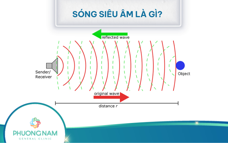 Sóng siêu âm là gì? Nguyên lý hoạt động và ứng dụng thực tiễn