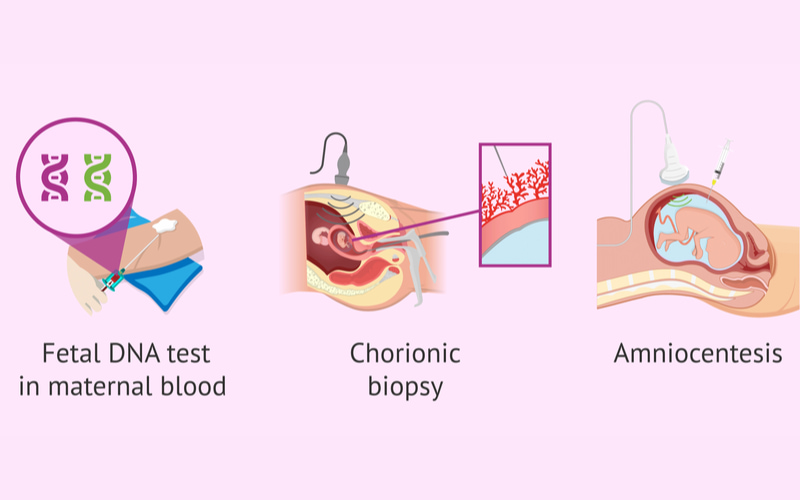 Trong y học hiện đại, có nhiều phương pháp xét nghiệm ADN khi mang thai