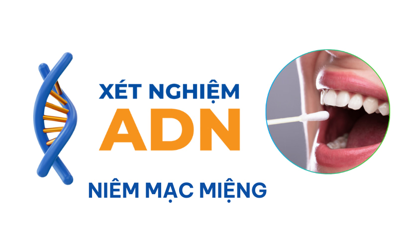 Mẫu tế bào niêm mạc miệng được sử dụng để xét nghiệm ADN