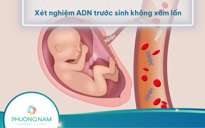 Xét nghiệm ADN trước sinh không xâm lấn: ưu nhược điểm, chi phí và lưu ý khác