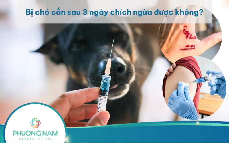 Bị chó cắn sau 3 ngày chích ngừa được không? Cần xử lý vế thương ngay thế nào?
