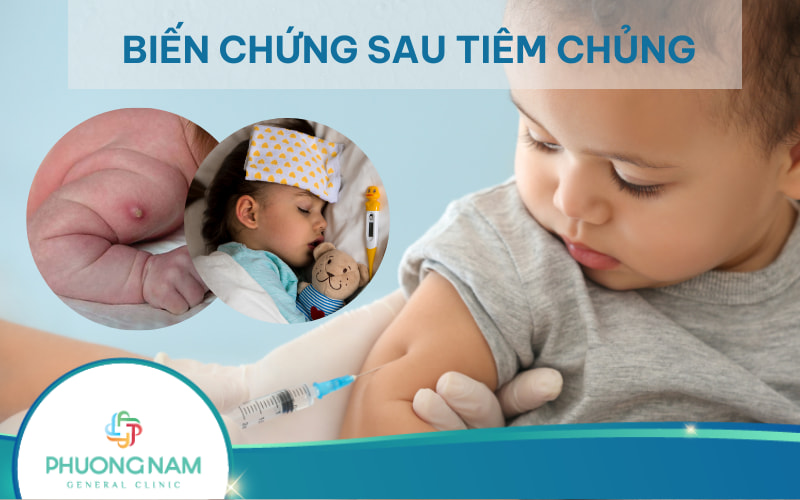 Biến chứng sau tiêm chủng: Cách nhận biết, theo dõi và xử lý an toàn