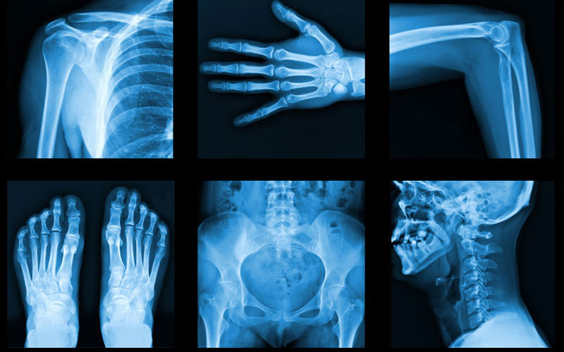 Công nghệ phát triển nên càng ngày người dân càng được tiếp cận đa dạng dịch vụ chụp X-quang hơn