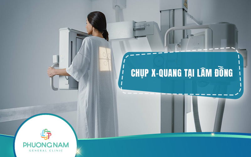 Chụp X-quang Lâm Đồng: Dịch vụ uy tín, giá cả hợp lý