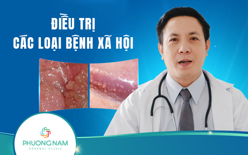 Điều trị các bệnh xã hội hiệu quả, an toàn