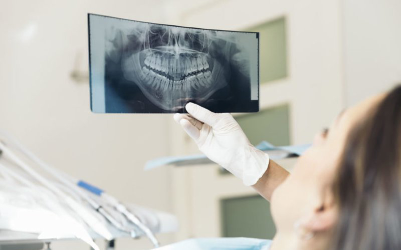 Chụp X-quang là phương pháp hỗ trợ quan sát các vấn đề bên trong cơ thể để từ đó có thể đưa ra các giải pháp khắc phục kịp thời