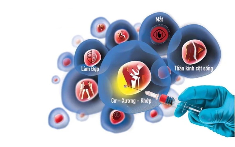 tế bào gốc đã được ứng dụng trong việc điều trị các bệnh sau: tiểu đường, viêm đa khớp, Parkinson, Alzheimer, viêm xương khớp, tai biến mạch máu não và chấn thương sọ não,