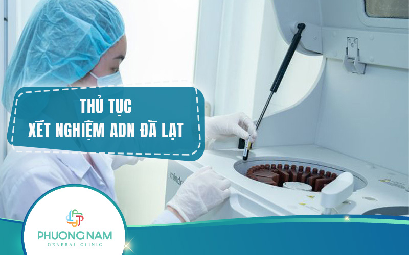 Thủ tục xét nghiệm ADN Đà Lạt – Nhanh chóng, chính xác