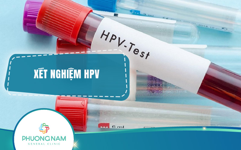 Xét nghiệm HPV: ý nghĩa, đối tượng, chi phí & quy trình