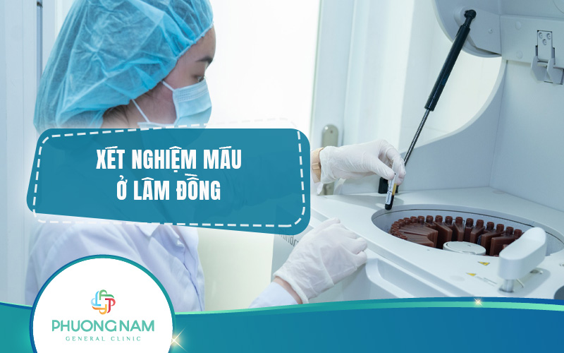 Dịch vụ xét nghiệm máu Lâm Đồng: Uy tín, An toàn, Giá tốt