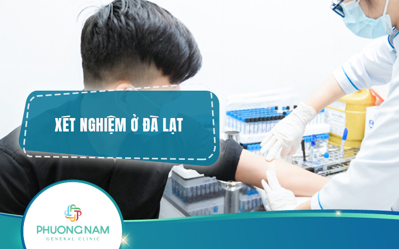 Top 5 địa chỉ xét nghiệm ở Đà Lạt uy tín, chất lượng