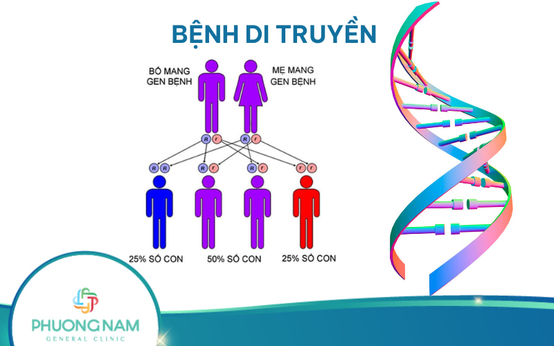 Các bệnh di truyền thường gặp nhất: Nguyên nhân, Triệu chứng và Điều trị