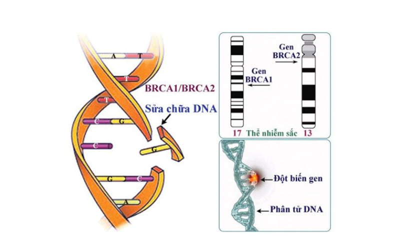 Người mang gen BRCA1, BRCA2 đột biến đối diện nhiều khả năng bị ung thư vú.